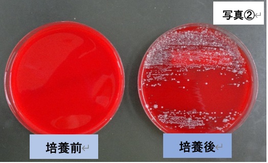培養検査