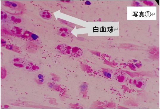 塗抹検査