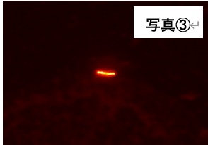 塗抹・鏡検検査